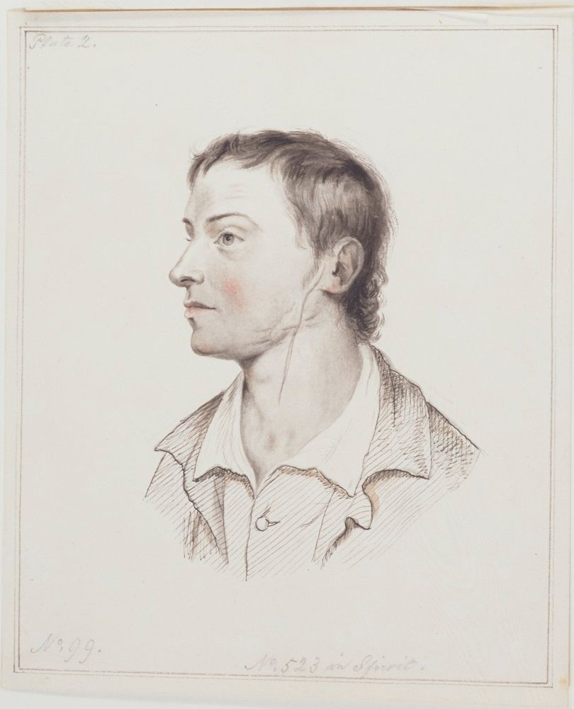 A drawing of a man looking to his right, with a scar extending from his ear to the middle of his neck