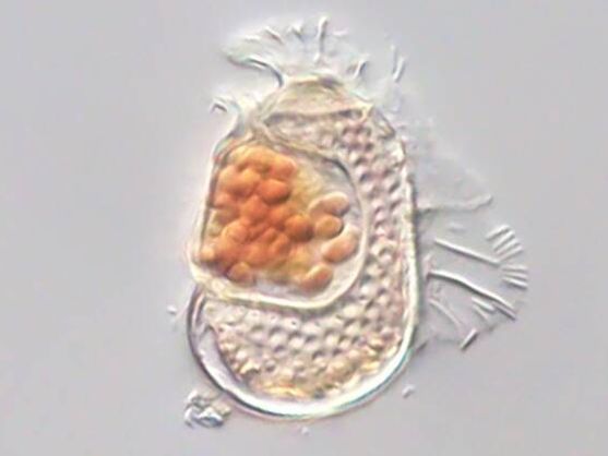 Sukunaarchaeum mirabile, visto al microscopio (Universidad de Tsukuba/Takuro Nakayama) Tiene el aspecto de un bajorrelieve, una figura ovalada rugosa y con flagelos alrededor, y una bolsa interna de corpúsculos esféricos más densos.