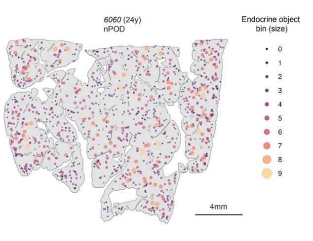 A representative spatial plot of endocrine objects in the pancreas, with the colour change reflecting the size of the endocrine objects