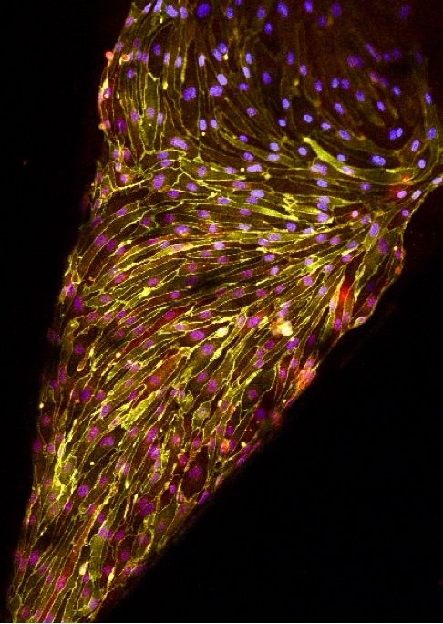 Confocal microscopy image of endothelial cells highlighting their tight junction proteins in yellow (ZO-1) and red (Claudin 5) on a black background 