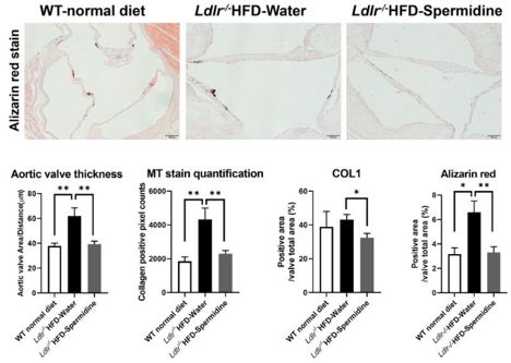 Alizarin red staining of aortic valves and bar charts showing increase in AV thickness, MT stain, COL1, and Alizarin red in the Ldlr-/- & HFD disease model that is reversed with spermidine.