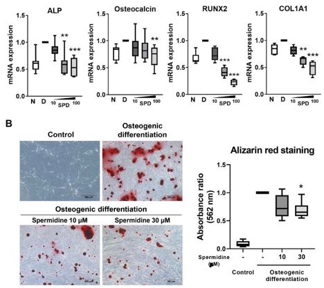 Box plots showing increase of ALP, Osteocalcin, RUNX2, and COL1A1 expression in diseased cells, which is reversed with treatment with spermidine. Alizarin red staining shows an increase with osteogenic media that is reversed with spermidine.