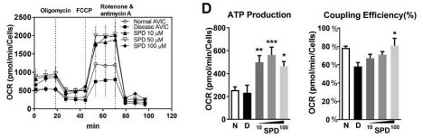 Seahorse assay showing decreased respiration in diseased cells. Spermidine treatment augments respiration beyond both healthy and diseased cells. Bar charts showing a similar pattern with ATP production and coupling efficiency.