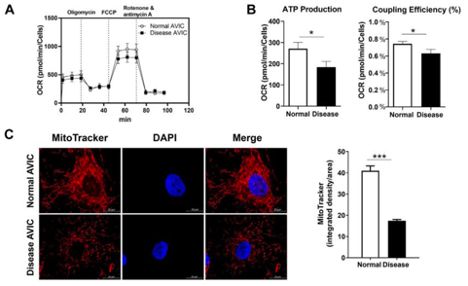 Seahorse assay showing decreased respiratory capacity in diseased AVICs. Bar charts showing decresaed ATP production, coupling efficiency, and mitochondrial staining with MitoTracker.