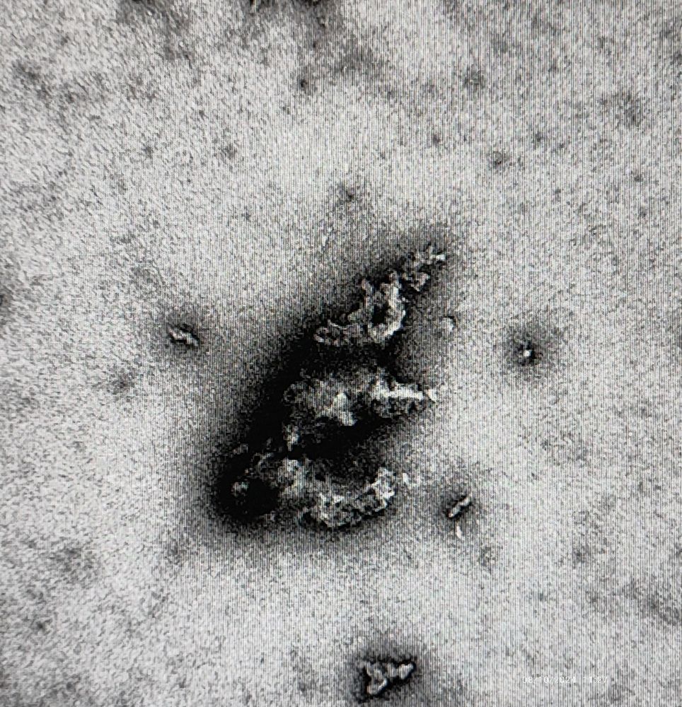 black and white image from an electron microscope with an object that looks like a four legged animal with a long nose