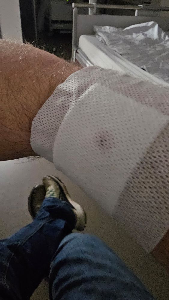 Pflaster auf dem rechten Unterarm, viel zu groß 😂