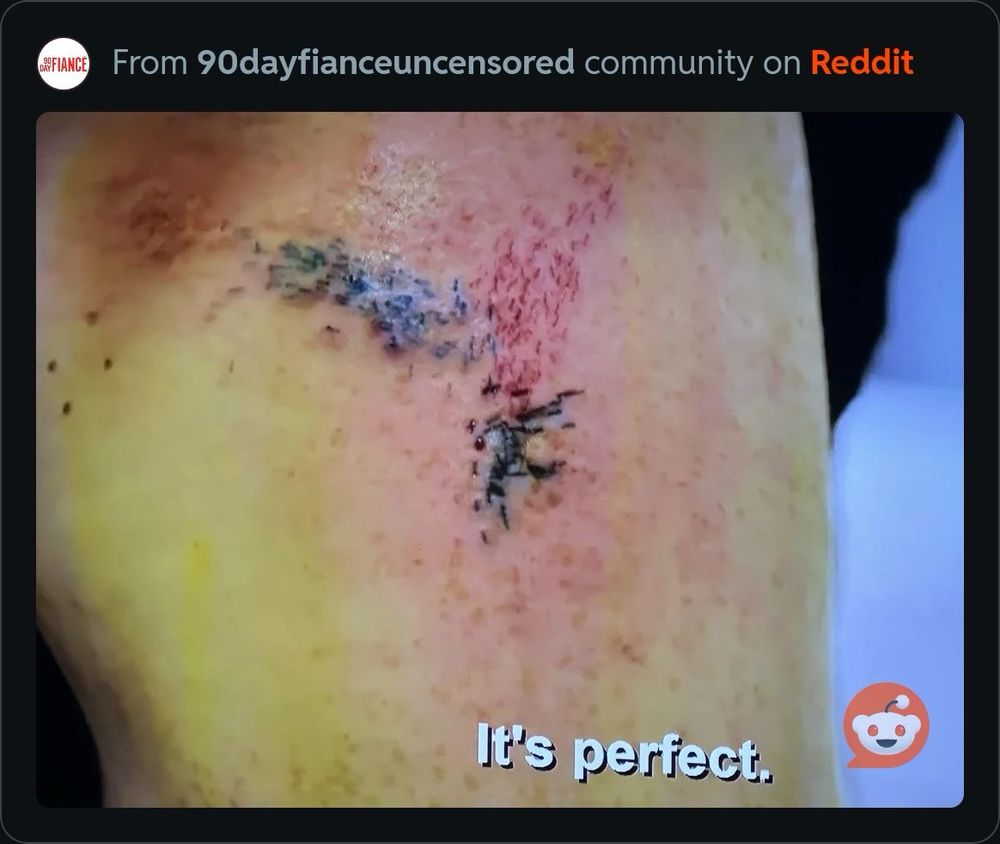 Screenshot of before the 90 days. Image is looking at a raw poorly done stick and poke tattoo on Loren’s forearm. There are a bunch of unconnected black dots that don’t form a visible pattern and a whole area that’s just raw and bloody with no ink deposition. Subtitle of Loren saying “it’s perfect.” 