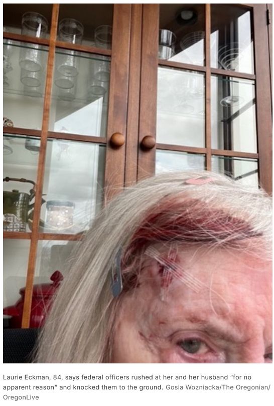 bloody photo

Laurie Eckman, 84, says federal officers rushed at her and her husband “for no apparent reason" and knocked them to the ground.Gosia Wozniacka/The Oregonian/OregonLive