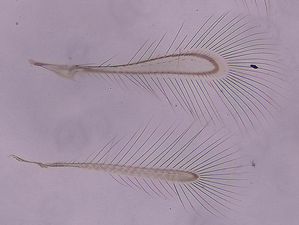 slide image of the forewing (above) and hindwing (below) of a tiny wasp