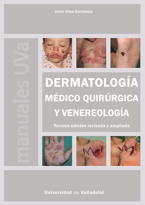 Manual de dermatología médico quirúrgica y venereología 