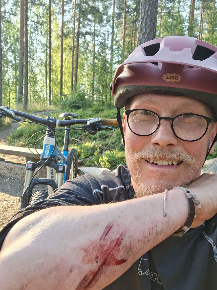 maastopyörä ja kaatumahaavoja käsivarressa kuskilla, taustalla polkua ja Puijon metsää