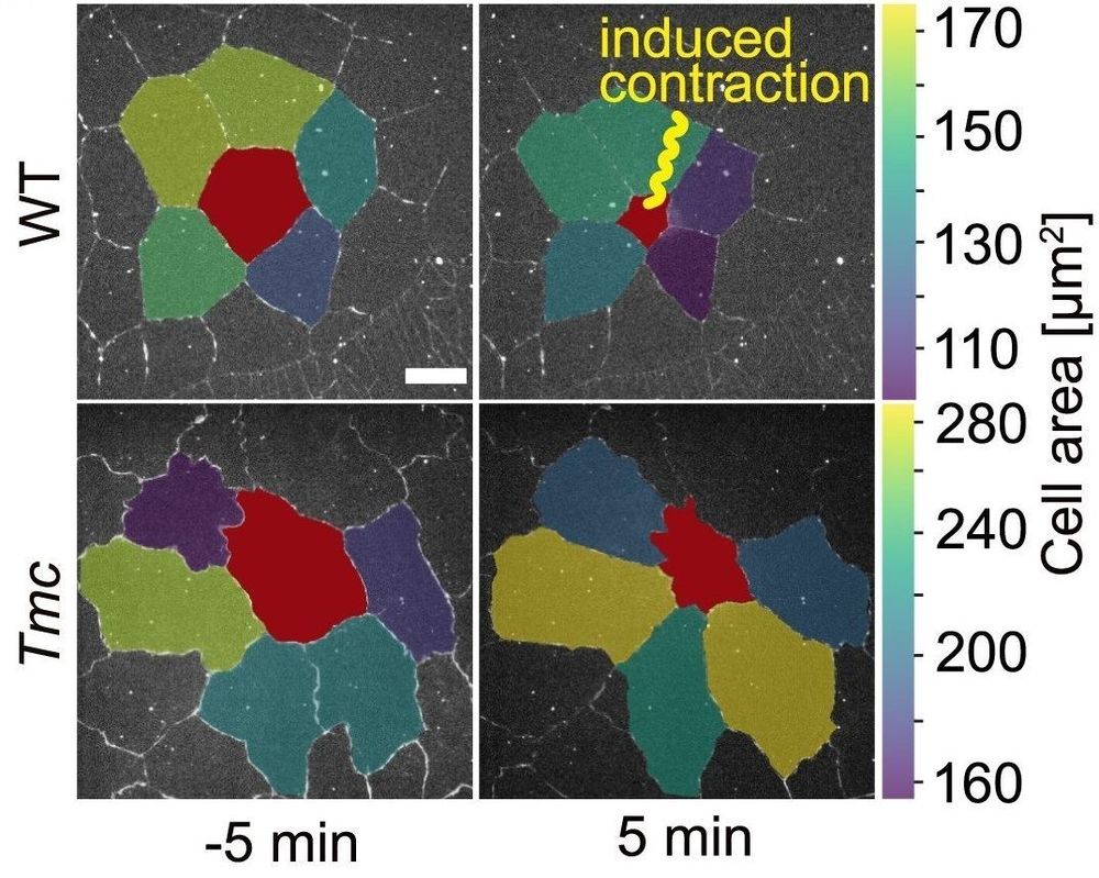 Experiment with contraction triggered by an optical stimulus of a cell (red) in tissues – results shown with force sensors (top) and then what happens when they are genetically turned off (bottom). The results showed that with force sensors, the surrounding cells contract more strongly than without. Scale bar: 0.001 Millimeter. 
Image thanks to: P. Richa, M. Häring et al. DOI: 10.1016/j.cub.2025.03.066