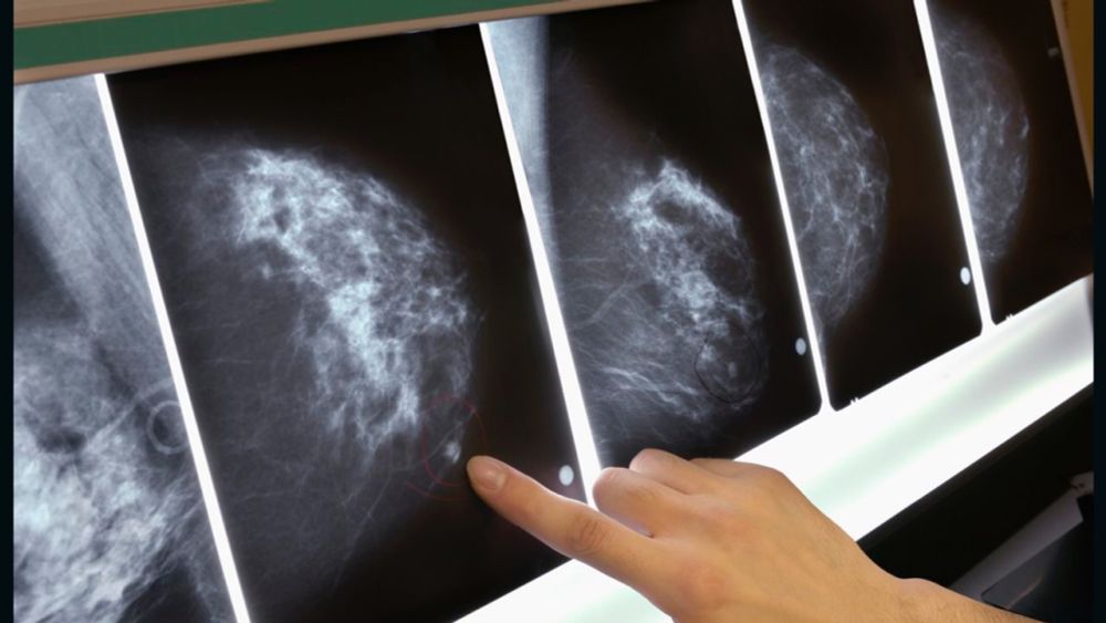 Chemicals linked to breast cancer leach into our foods, study finds — H2O IQ