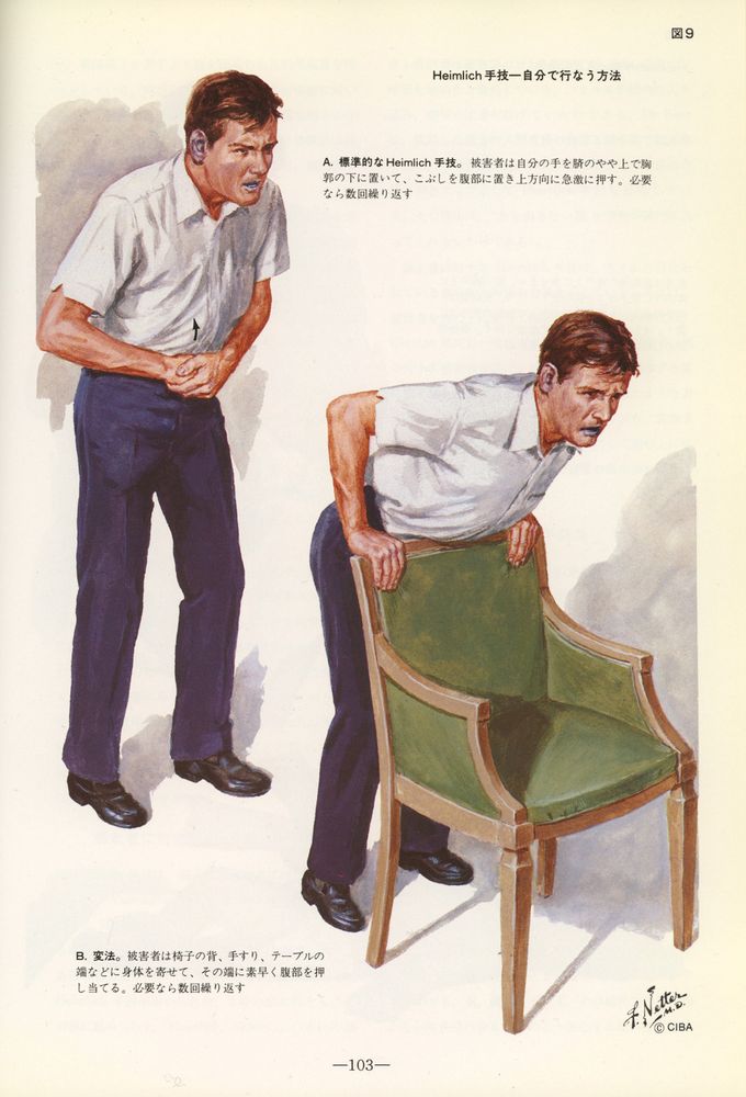 Dude giving himself the Heimlich over a green chair. Handsome guy, ugly chair. 