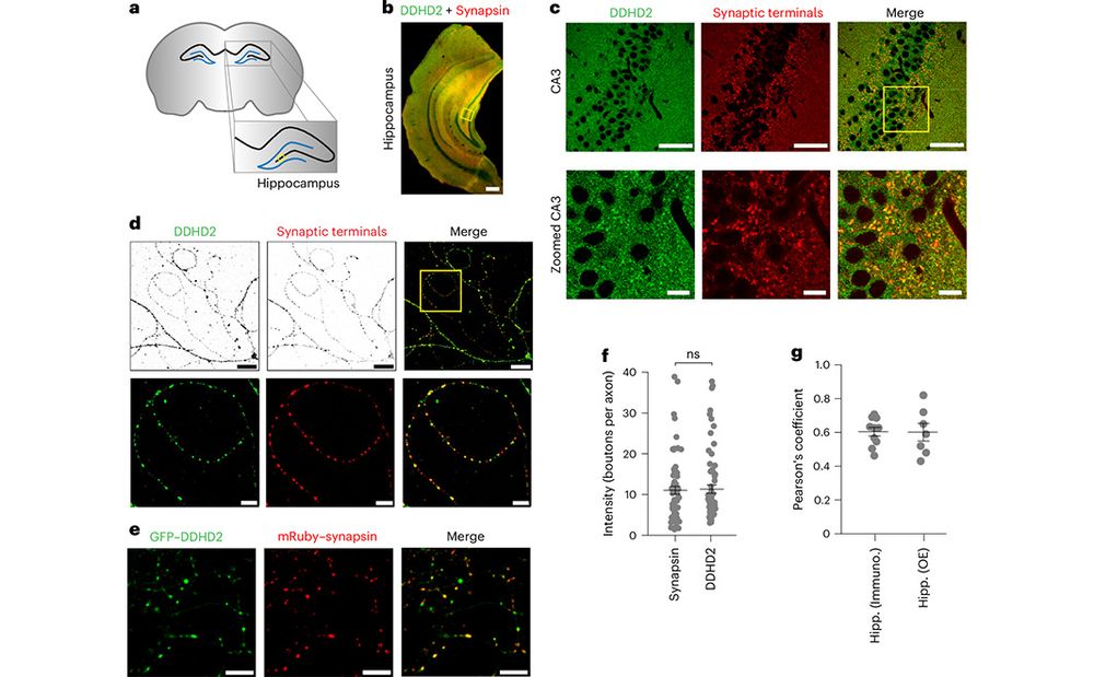 This is figure 1, which shows DDHD2 lipase localizes to synaptic terminals in the hippocampus. 