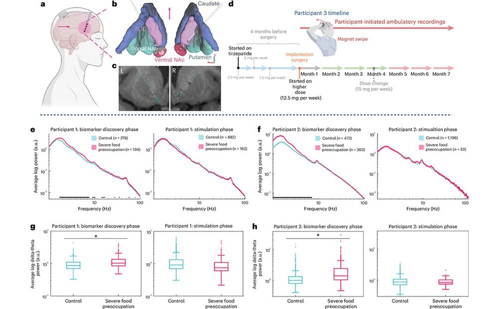 This is figure 1, which shows background information of participant 3 and association of increased delta–theta power in the ventral NAc with severe food preoccupation in participants 1 and 2. 
