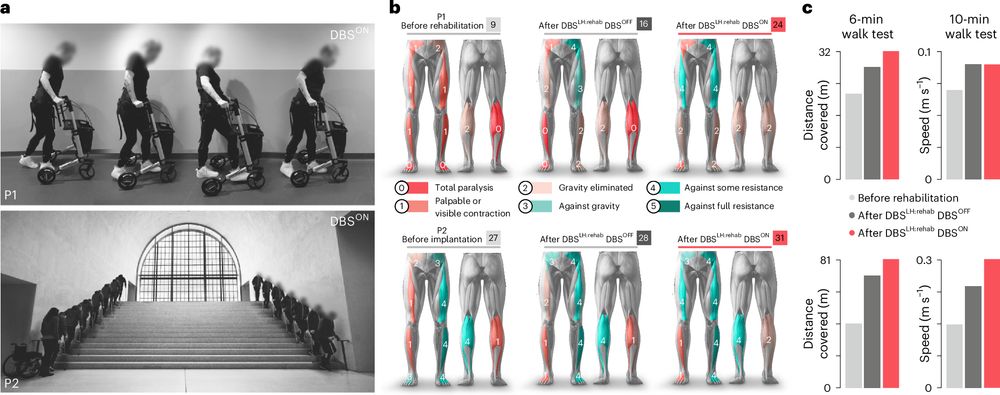 This is figure 6, which shows that DBSLH mediates long-term improvements in walking in humans with SCI. 