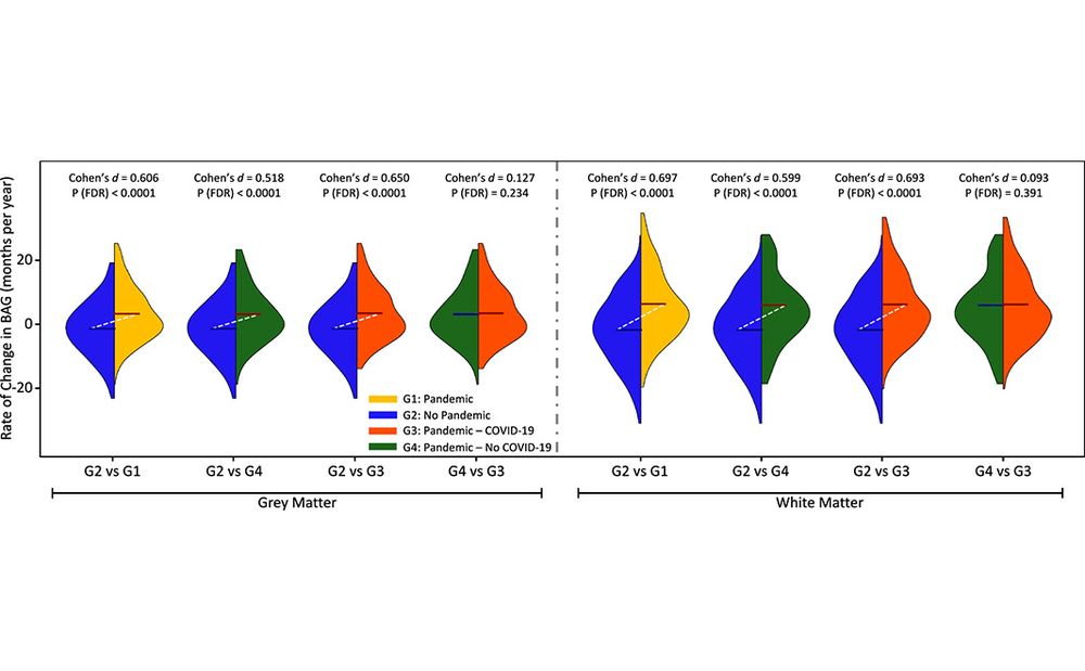 This is figure 2, which shows the effect of COVID-19 and the pandemic on brain ageing. 