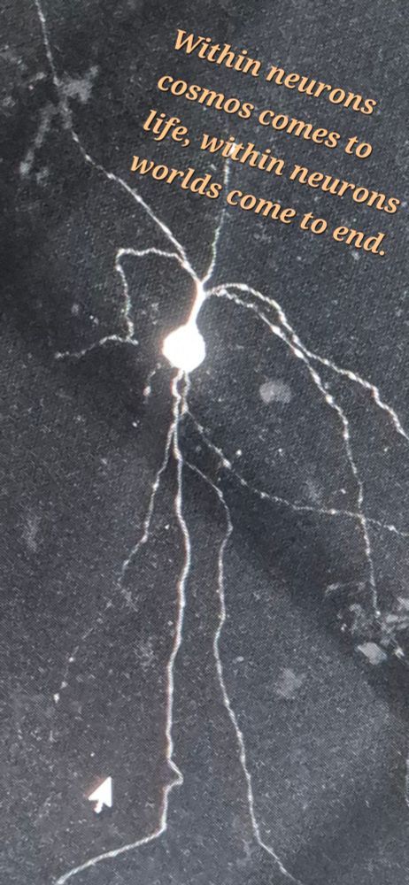 Biocytin-filled neuron obtained from cortical tissue of a 10-year-old child.