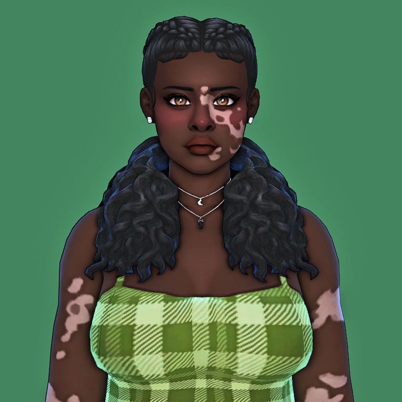 A young adult black woman with vitiligo, brown eyes, earring and a necklace.  