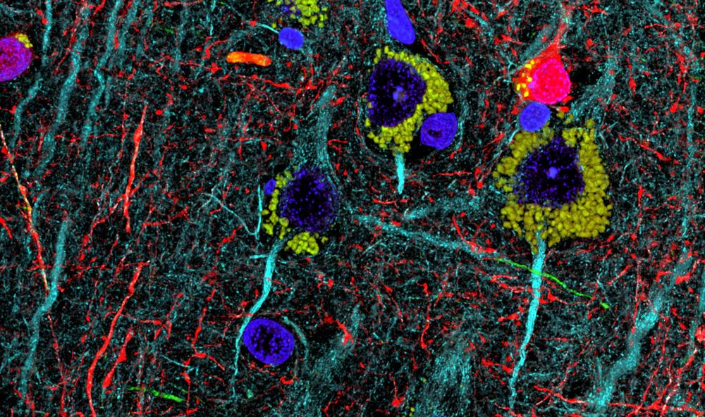 Immunofluorescence array tomography image from human cortex. Several colorful neurons can be seen.This is a volume reconstruction from ~30 serial sections, 70 nm each, that were labeled with three different antibodies. Yellow lipofuscin granules surround the blue nuclei of some of the neurons. 
