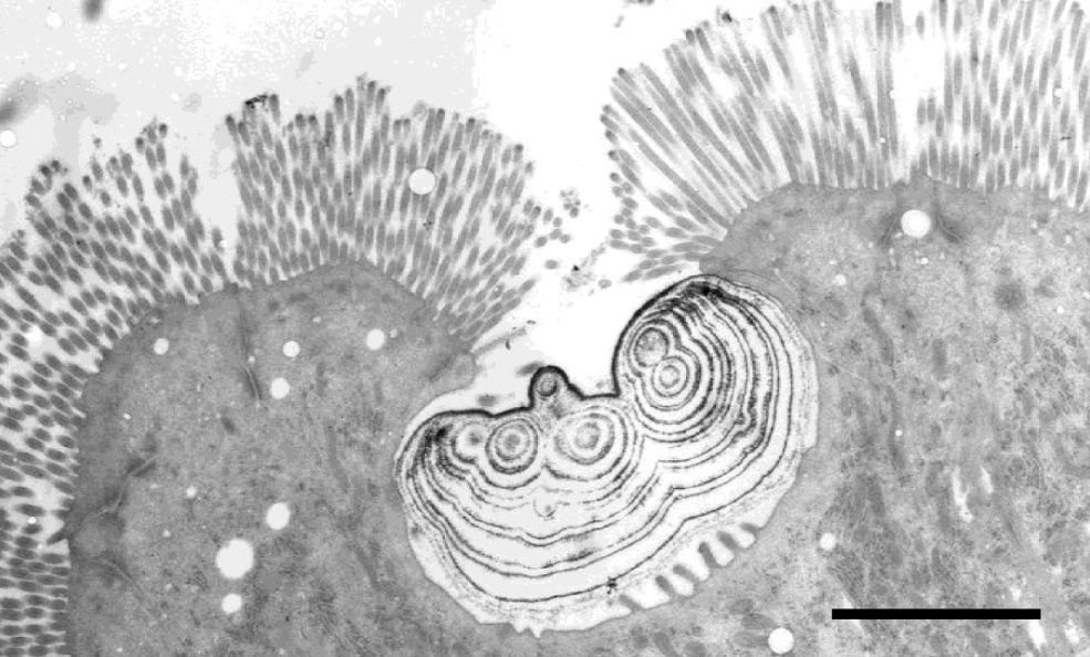 A photo taken with a transmission electron microscope showing a slice through the small intestine of a Burmese python and depicts the apical crypt and calcium-containing spheroid in a specialized enterocyte. 

In the centre is an irregularly shaped spheroid which contains rings of calcium deposited over time, much like the rings of a tree. Underneath the spheroid are the small microvilli characteristic of these specialized cells. The grey cells to the right and left of the cell containing the spheroid are normal enterocytes which have the long microvilli normally found in pythons as they are digesting a meal.
