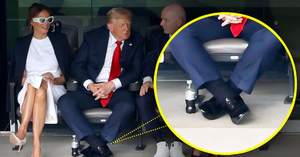 Trump, 79, Had Emergency Heart Tests Because of Swollen Legs