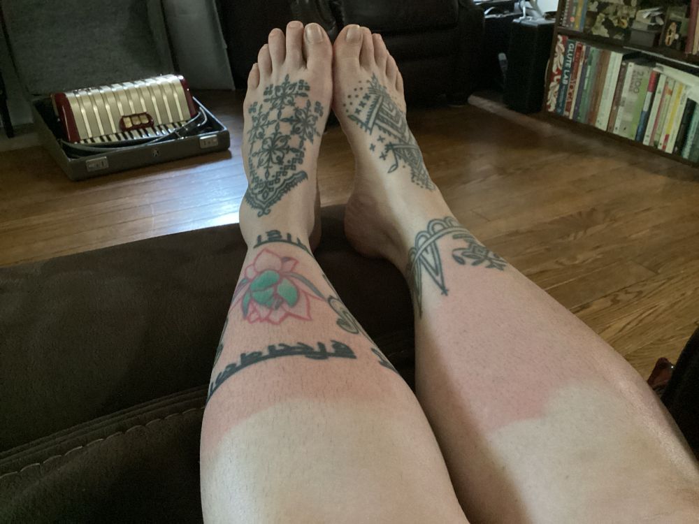 Two sunburned legs.