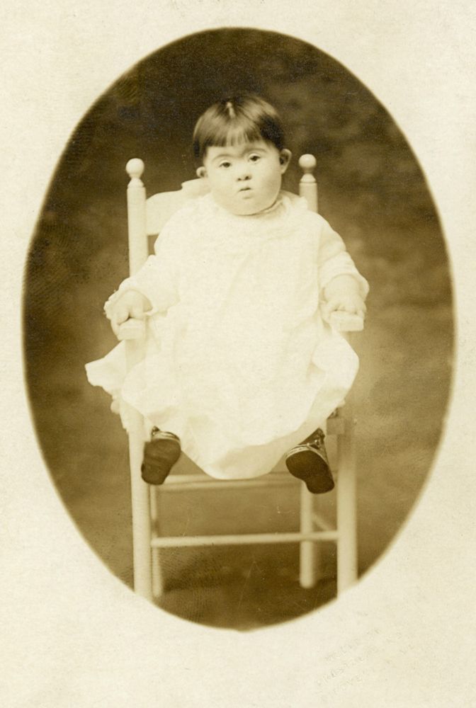 A sepia-toned photo features a baby with Down Syndrome wearing a white gown and tiny little shoesies sits in a white chair. She has dark hair and round, kissable cheeks.