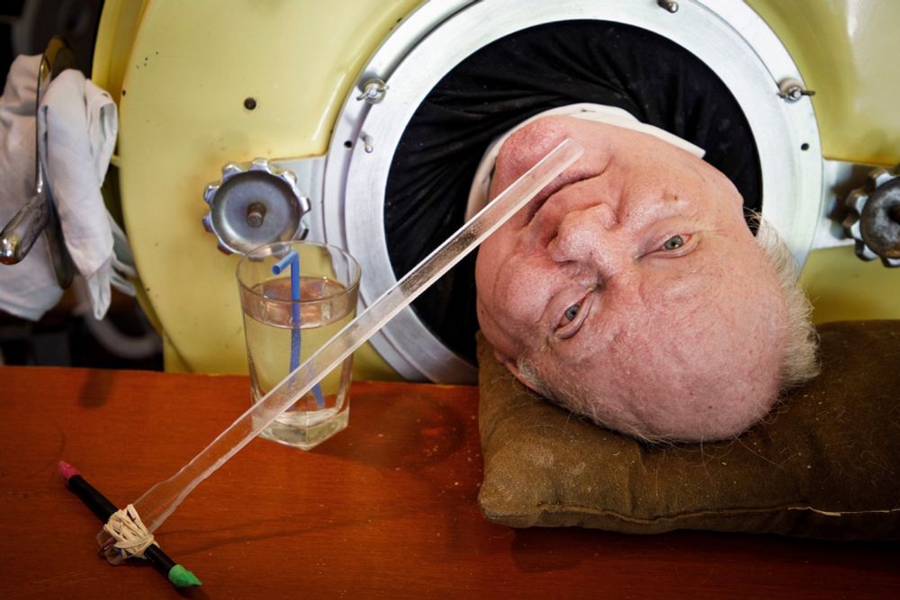 Paul Alexander, who spent seven decades using iron lung, dies at 78