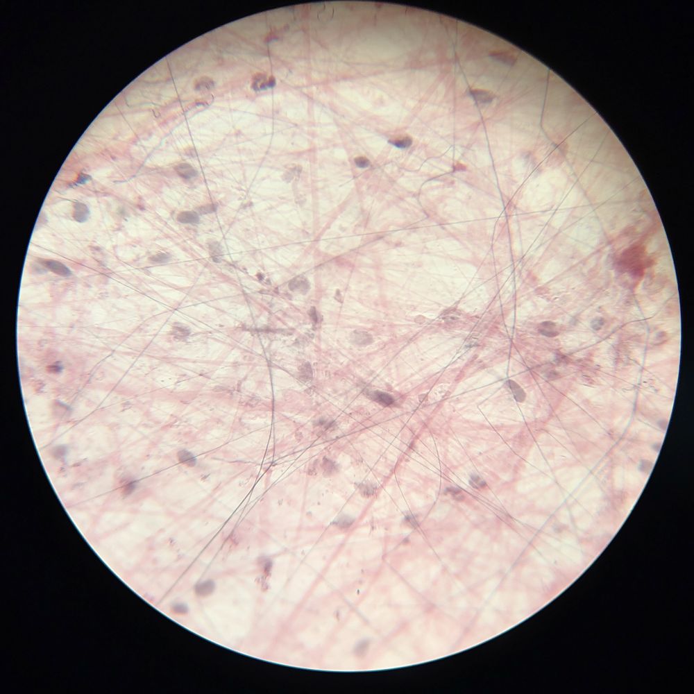 Microscopic view of areolar connective tissue 
