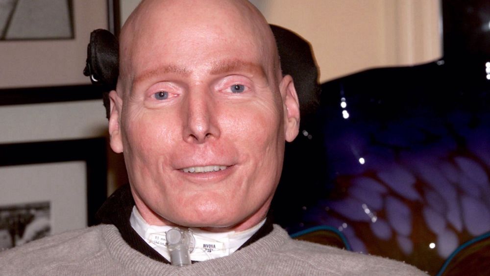A photo of Reeve after his spine injury.