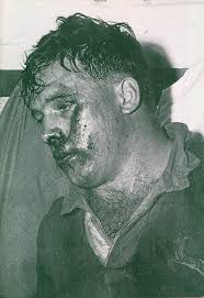 Jaap Bekker after being taught his manners by Kevin Skinner. 