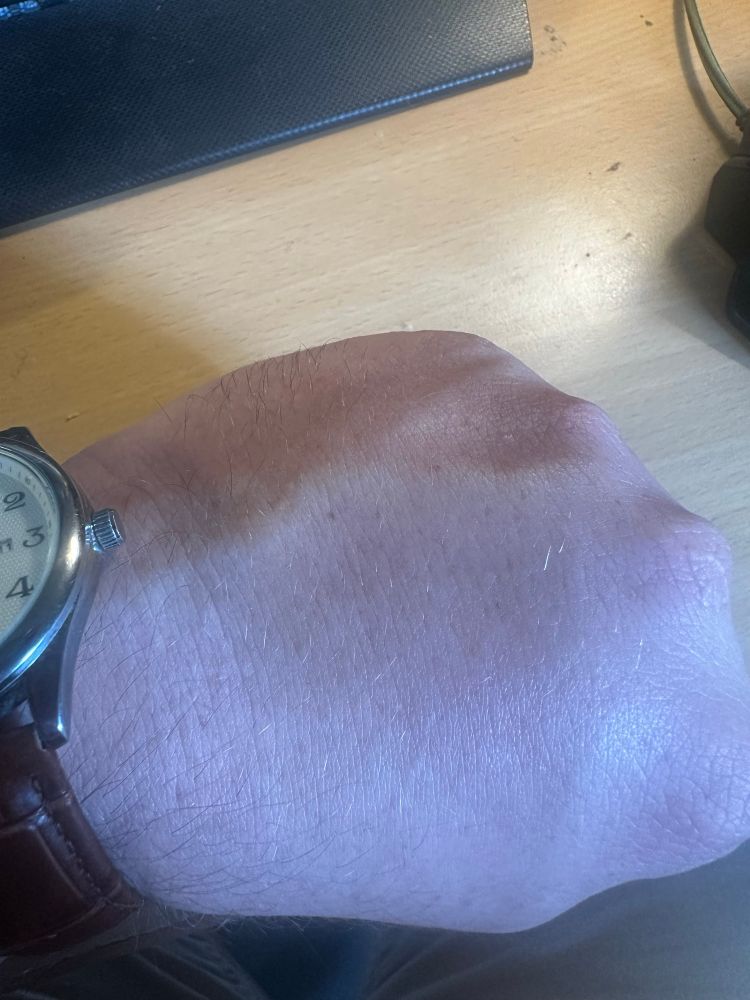 Ein Handrücken mit Venen