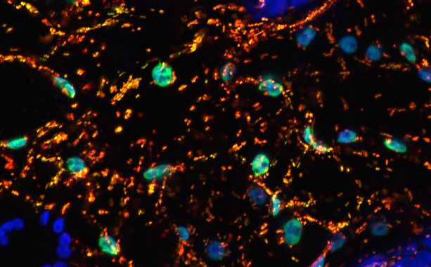 Fluorescence microscopy of plant leaf cells showing mitochondrial and chloroplast targeting of proteins.