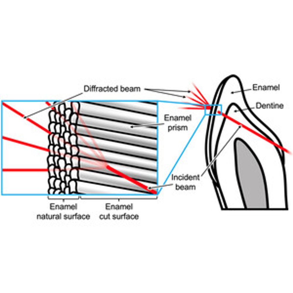 Energy-dispersive Laue diffraction analysis of the influence of statherin and histatin on the crystallographic texture during human dental enamel demineralization