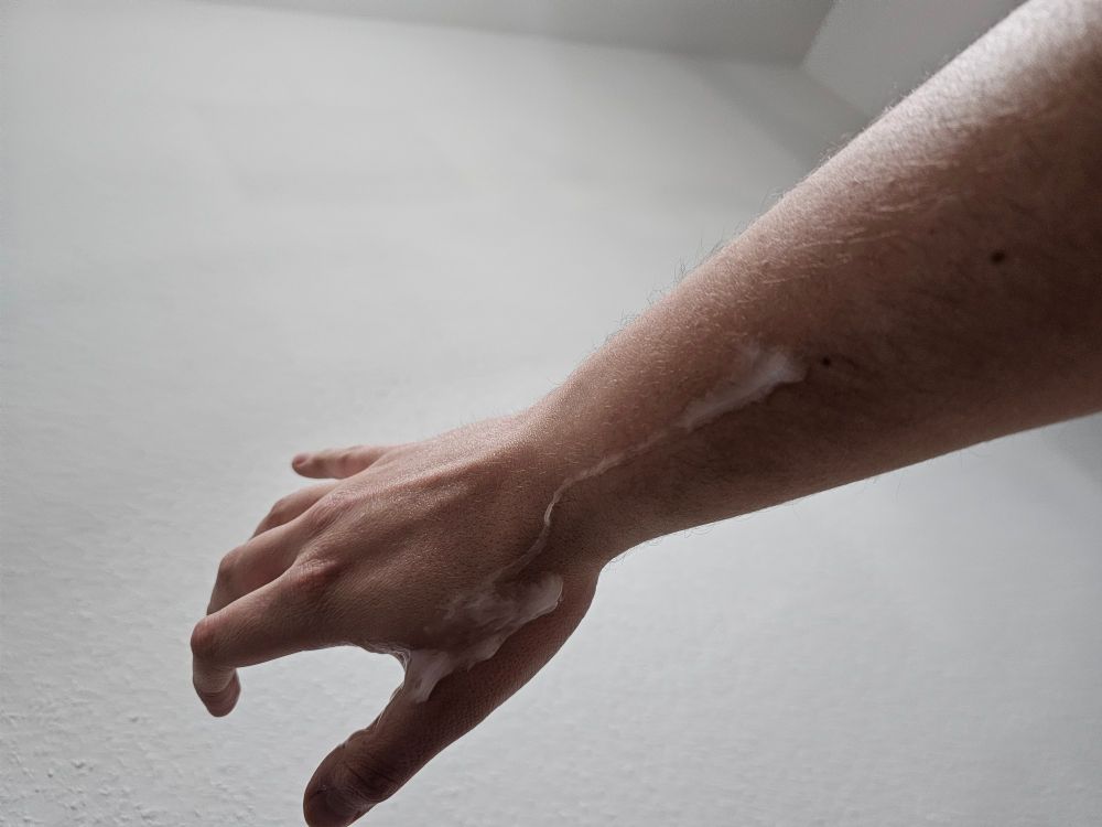 Hand and arm with a line of a suspicious white thick fluid