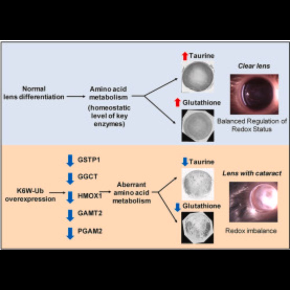 Unbalanced redox status network as an early pathological event in congenital cataracts