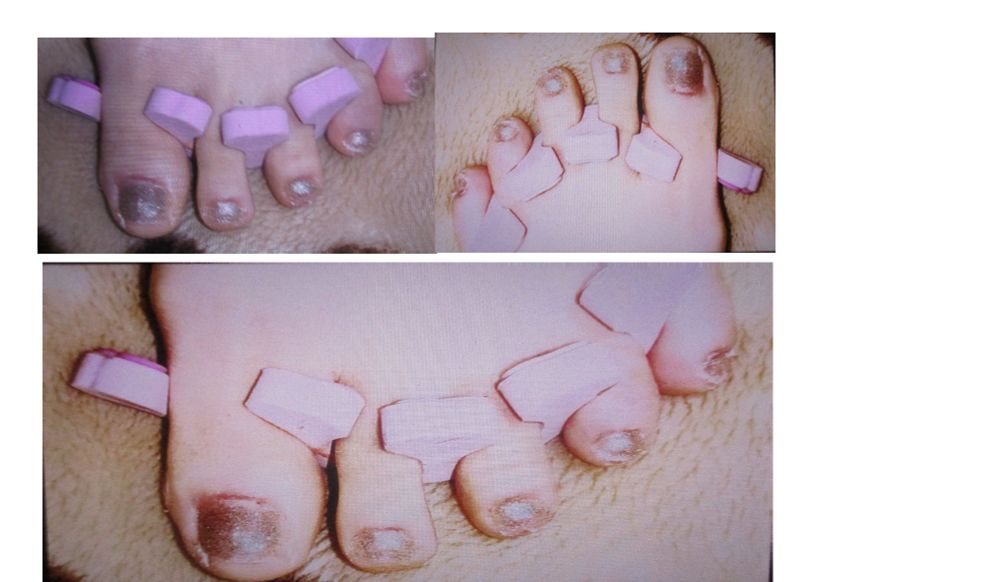 秋冬仕様の大人派ギャルなフットジェルネイルデザイン