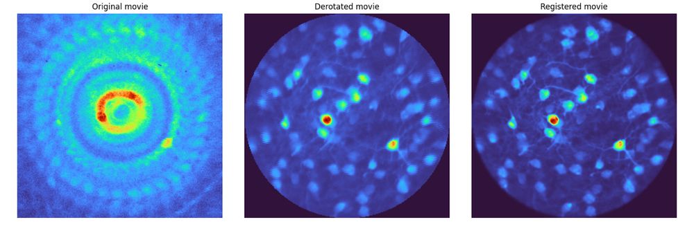 Image showing a rotated multiphoton image of some cells being derotated by the derotation software. 