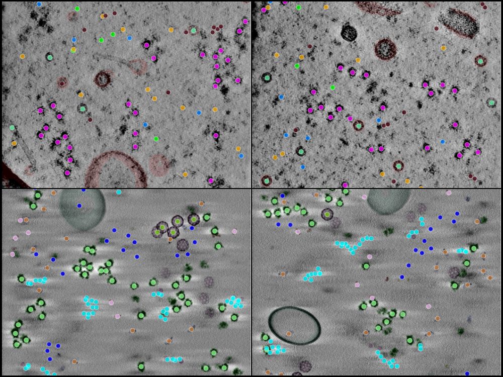 A 4-panel image showing tomographic slices and annotations from CZII's object detection challenge.