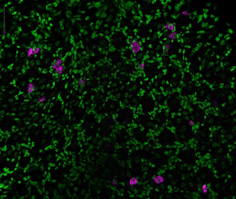 Cells of the mouse dorsal root ganglion. Cold sensing sensory neurons are small cells and are stained with HCR in situ hybridisation probes against TRPM8 mRNA