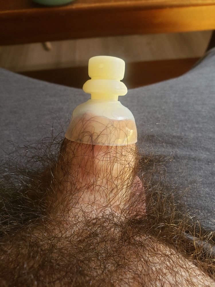 foreskin device on, holding my partial-foreskin in place