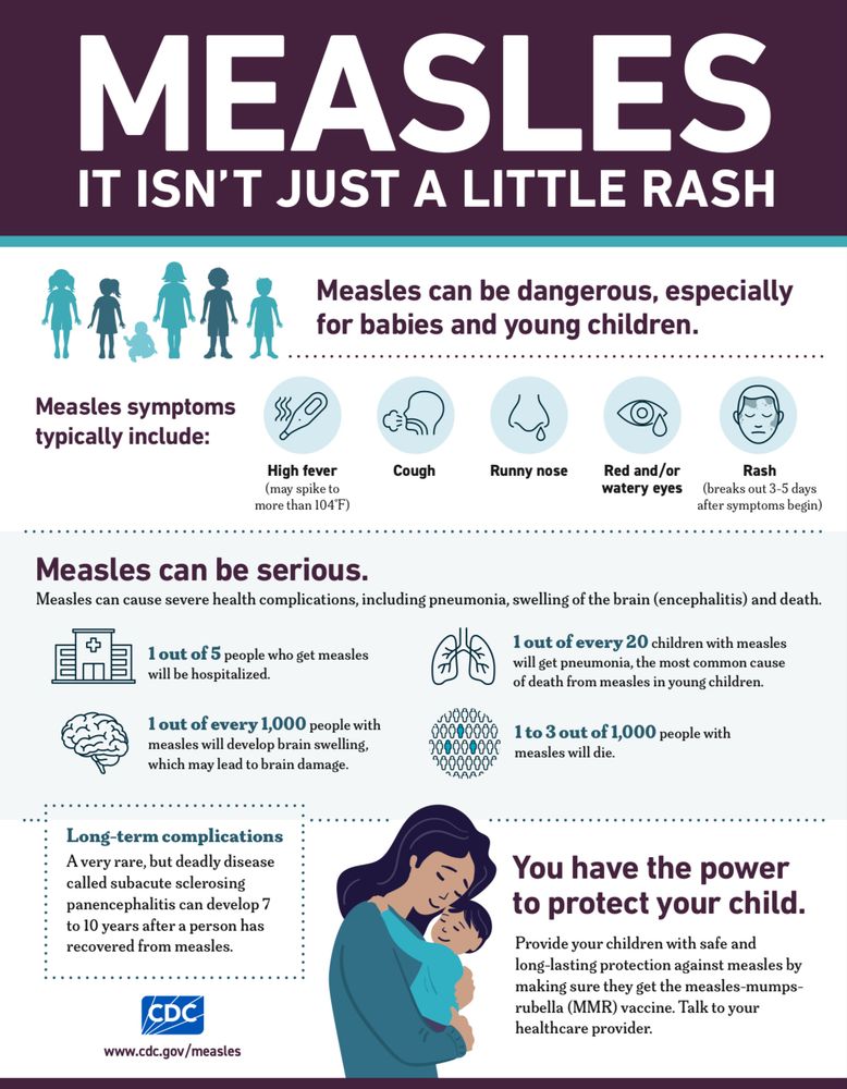 CDC purple infographic. Title: “Measles. It isn’t just a little rash”. Symptoms listed: high fever, cough, runny nose, red watery eyes, rash 3–5 days later. Risks: pneumonia, brain swelling, death. Stats shown: ~1 in 5 hospitalised; ~1 in 20 children get pneumonia; ~1 in 1,000 develop encephalitis; 1–3 in 1,000 deaths. Notes rare long-term SSPE years later. Closing message: protect children with MMR vaccine; talk to a healthcare provider.