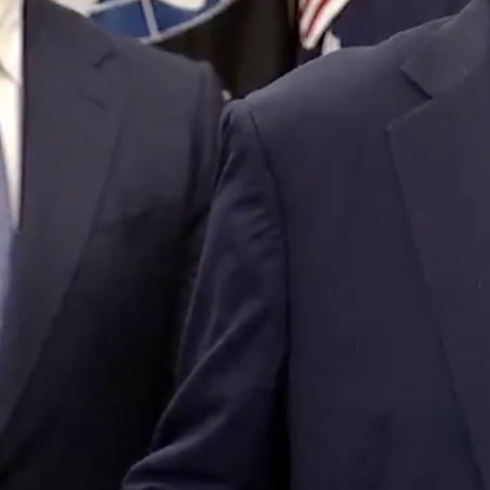 A close up of his arm. The fabric is draping strangely. 