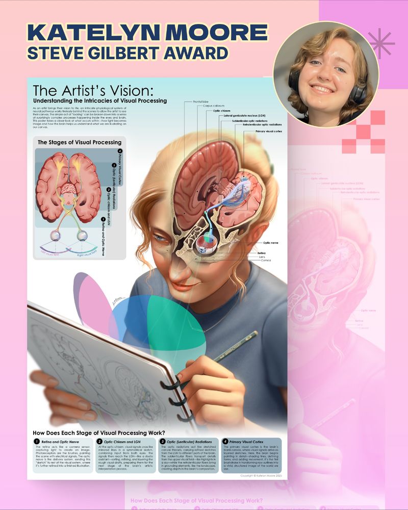 Student photo and infographic of the visual pathway from eye to visual cortex.