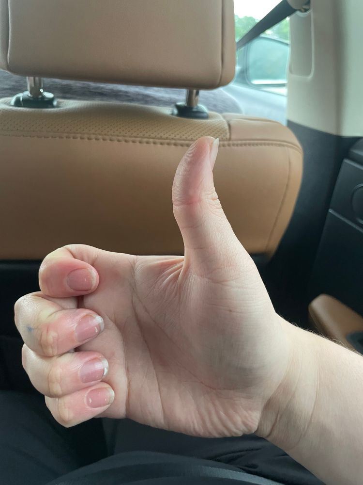 A hand with the palm facing toward the camera and the thumb raised into an upward position. The entire palm is visible, and the fingers are curled and touch their own bases. 