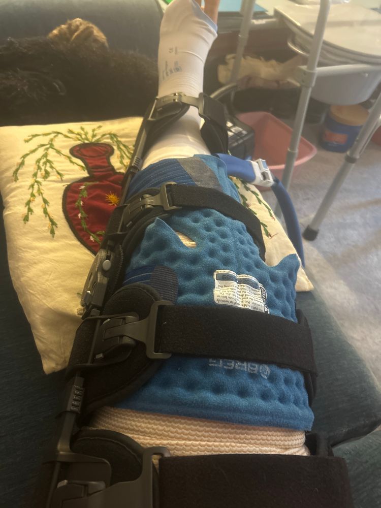 My left leg in a fancy brace that has a hinge in the knee joint that’s locked in extension mode, 4 straps across the top, and an “ice” pack that’s fed by cold water from an attached cooler you put ice water in. It is propped up on a pillow