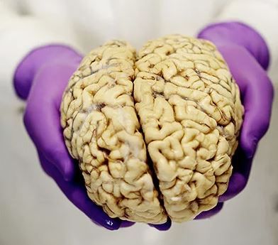 A brain ready for dissection, held in hands with purple rubber gloves (image for illustration purposes, taken from the Guardian newspaper).