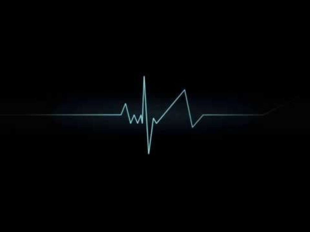 Alex M Vs Marc Van Damme - Died In Your Arms Tonight (Prowheel Remix)